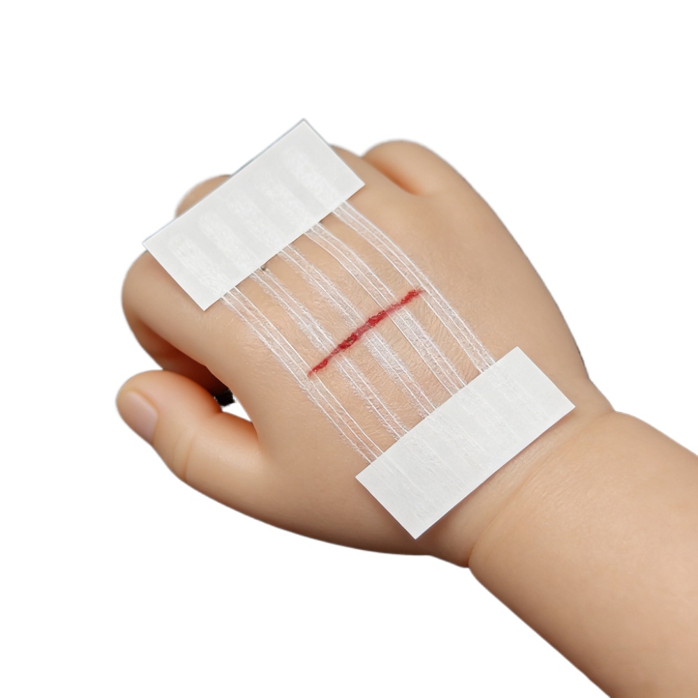 5 ストリップ創傷皮膚閉鎖ストリップ産後創傷修復美容外科スト - Medical Label のレビューと価格