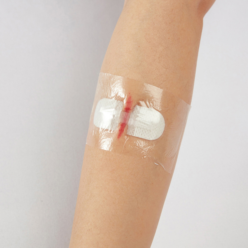 * 1pc ポリエステル滅菌ストリップ傷跡除去剤滅菌応急処置 - Medical Label のレビューと価格